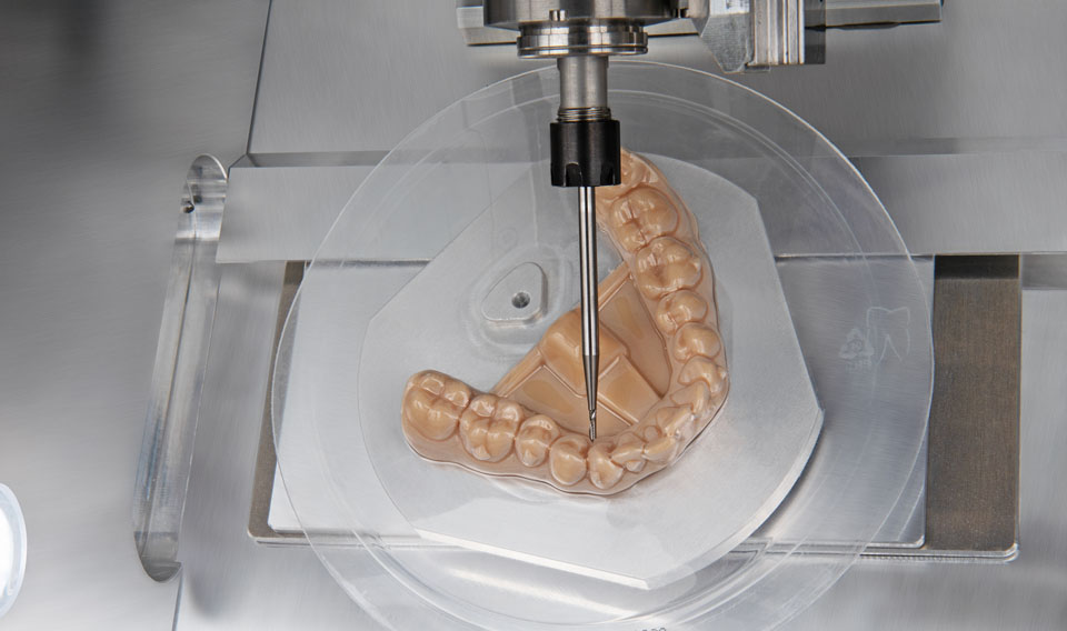 Clear aligner treatment consultation